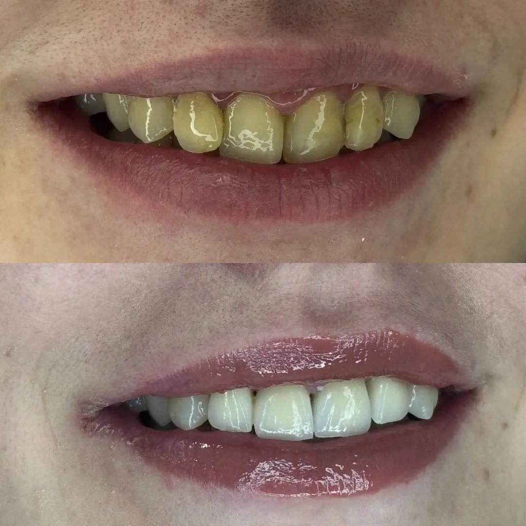 Transformacija osmijeha